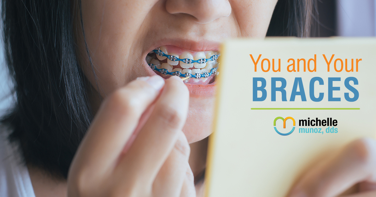 Munoz-Blog-11-2018 girl examining her braces in a mirror