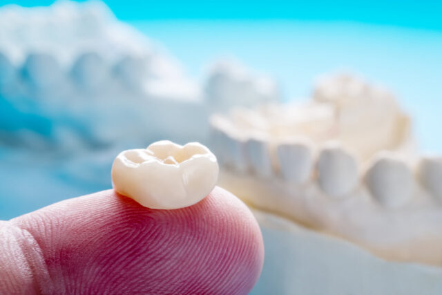 what is dental crown what is dental crown