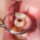 How To Prevent Tooth Decay